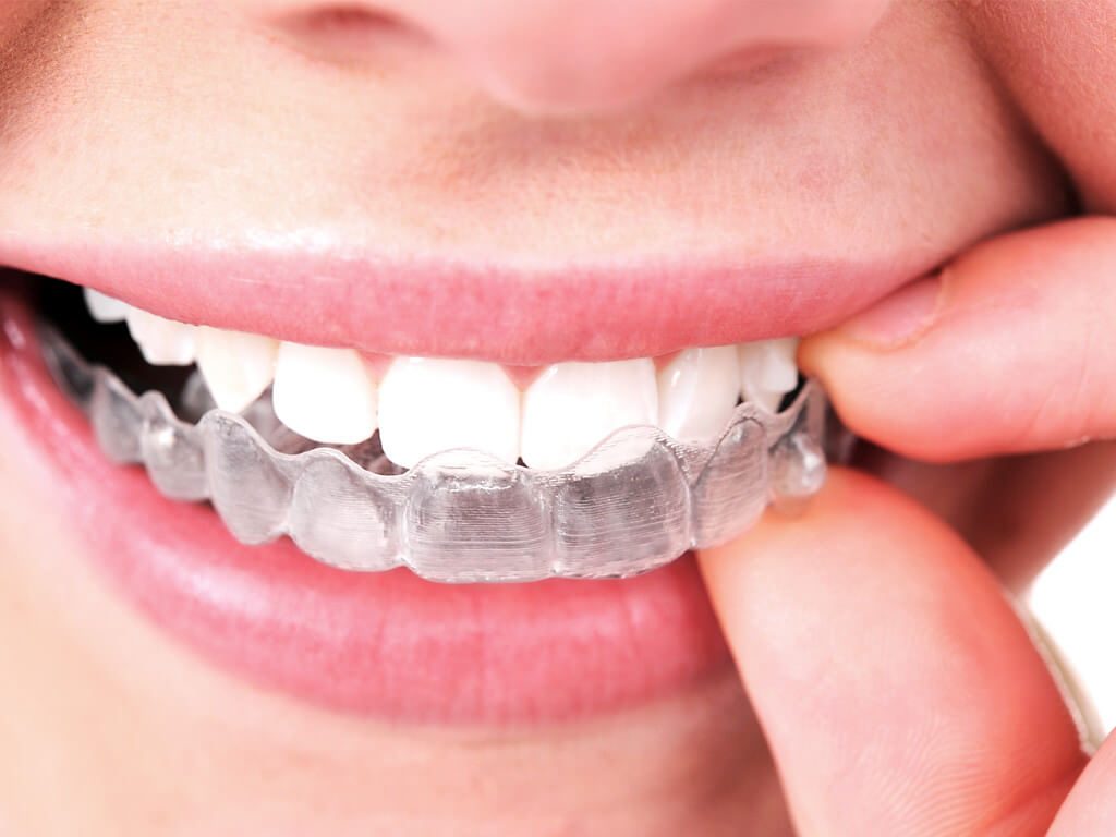 teeth cover